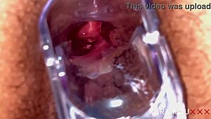 Mature Anal Gaping with Speculum 😏