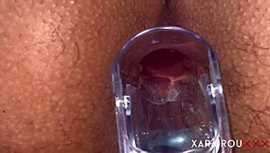 Mature Anal Gaping with Speculum 😏