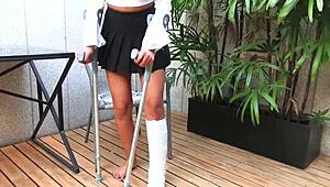 Hey, did you see that car accident with the cast leg?