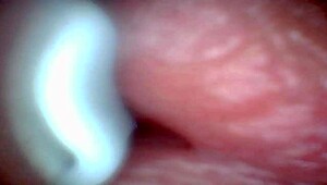 Ever wonder what endoscope sees during sloppy cumshot? Huge cocks drip creampie from public double anal with toys